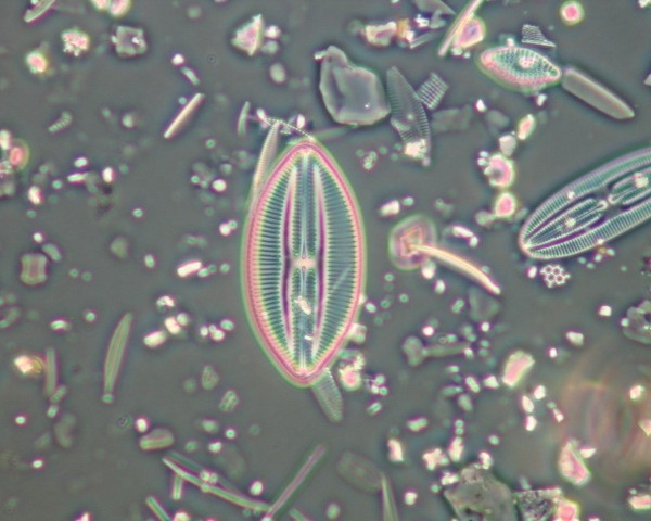 Diatom closeup under microscope