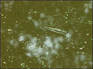 blue-green algae