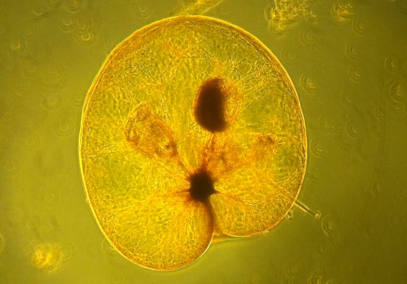 Noctiluca scintillans under a microscope